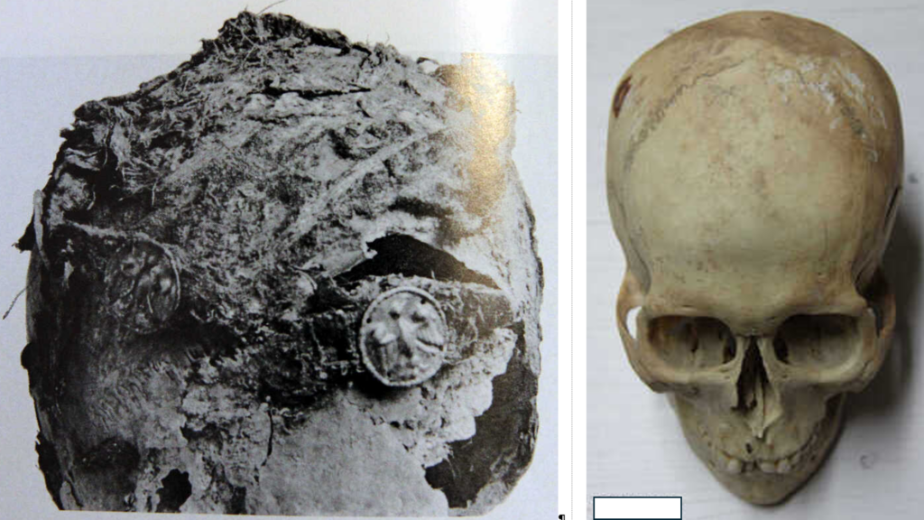 Villach-Judendorf - Black and white picture of archaeological textile find and a human skull